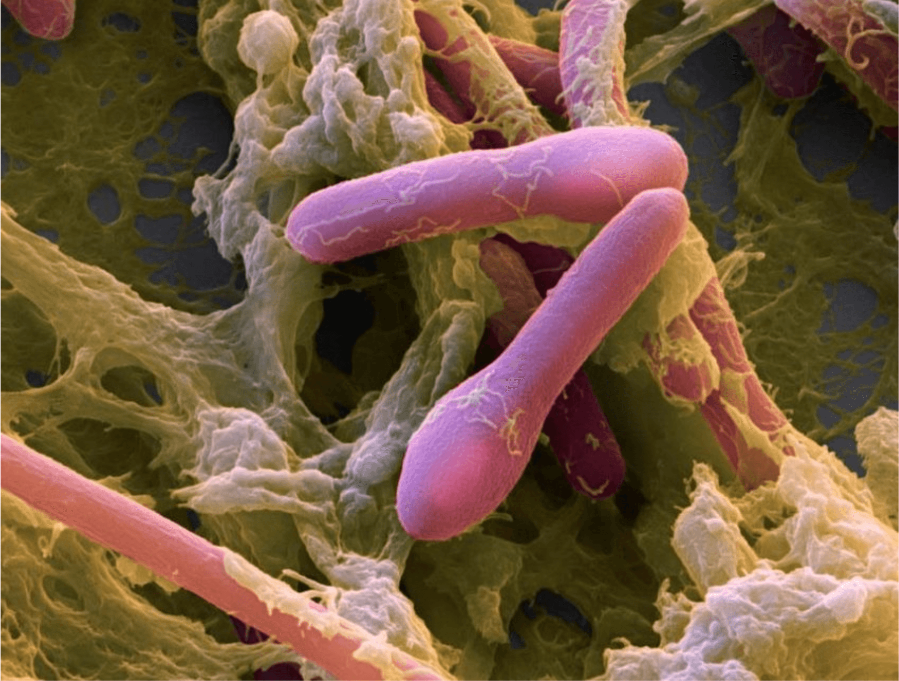 Botulinum bacteria